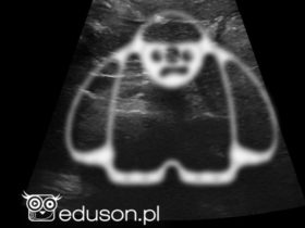 Ultrasonograficzny narząd Yeti
