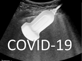 Jak poradzić sobie z oceną usg płuc u pacjenta z COVID-19?