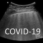 Ultrasonograficzny obraz płuc u pacjentów z COVID-19 - Portal wymiany wiedzy o ultrasonografii - Eduson
