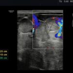Od nefrologa do gastroenterologa... | Portal wymiany wiedzy o ultrasonografii - Eduson