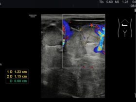 Od nefrologa do gastroenterologa... - Portal wymiany wiedzy o ultrasonografii - Eduson