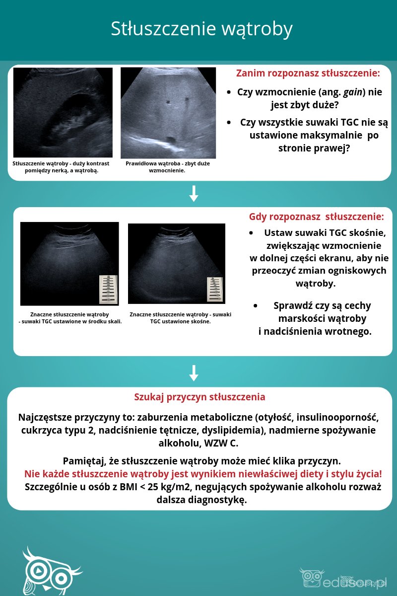 Podwyższona echogeniczność wątroby - Portal wymiany wiedzy o ultrasonografii - Eduson