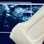 #98 Mobilne głowice usg | Portal wymiany wiedzy o ultrasonografii - Eduson