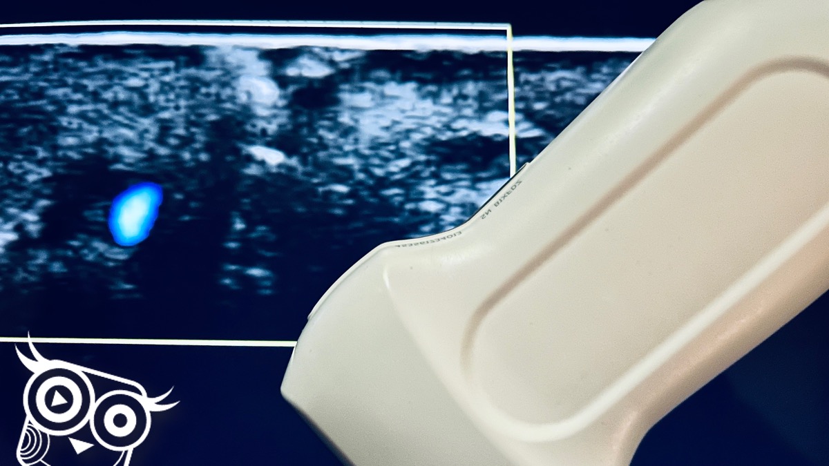 #98 Mobilne głowice usg - Portal wymiany wiedzy o ultrasonografii - Eduson