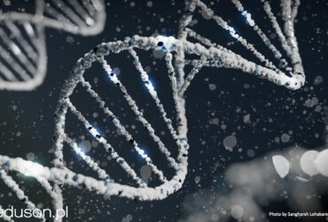 #204 USG i genetyka - torbiele nerek. | Portal wymiany wiedzy o ultrasonografii - Eduson